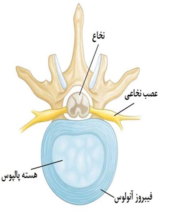 دیسک بین مهره ای