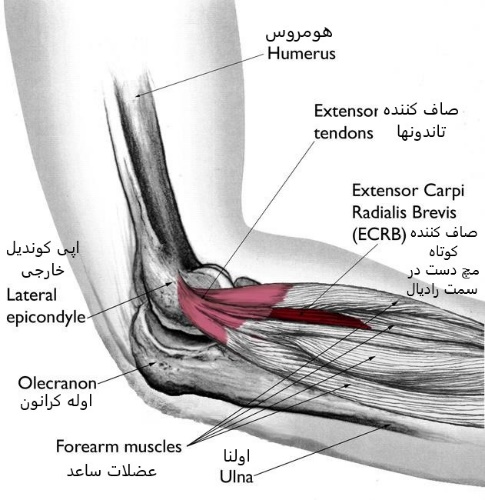 آرنج تنیس بازان
