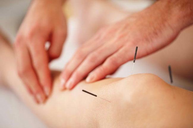 طب سوزنی برای زانو درد
