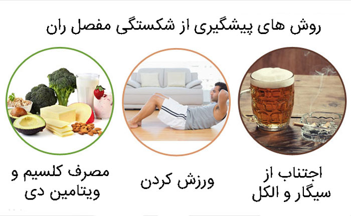 پیشگیری از شکستگی مفصل ران