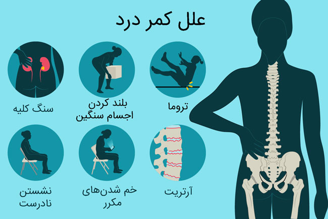 علل کمر درد