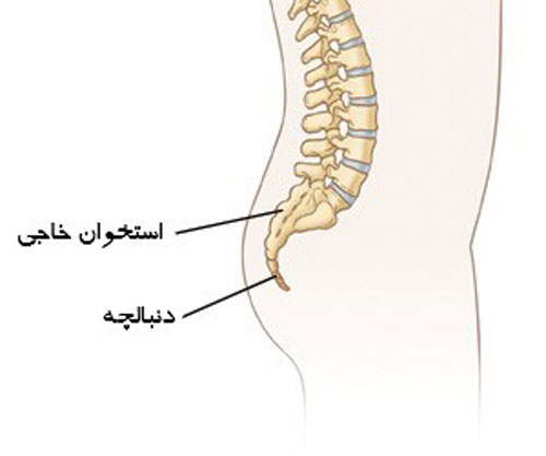 شکستگی دنبالچه