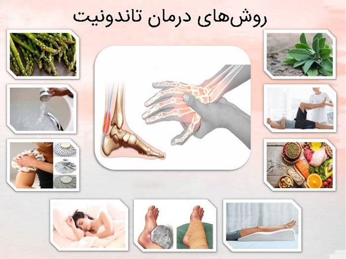 درمان تاندونیت