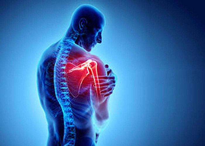 شانه یخ زده یا کپسولیت چسبنده شانه