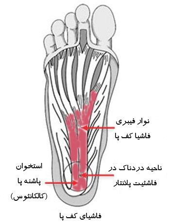 آناتومی فاشیای کف پا