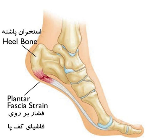 علل فاشئیت پلانتار