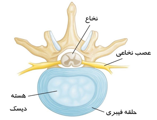 دیسک بین مهره ای