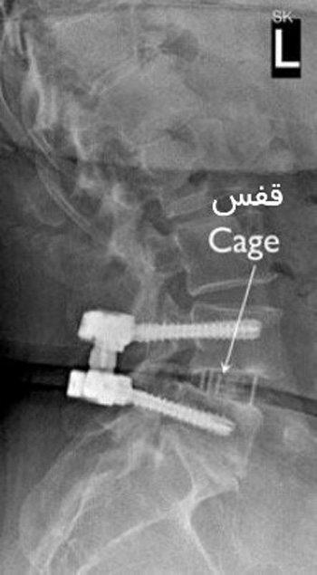 عکس رادیولوژی