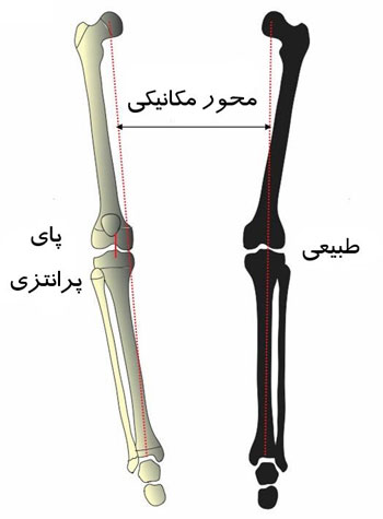 پای پرانتزی چیست
