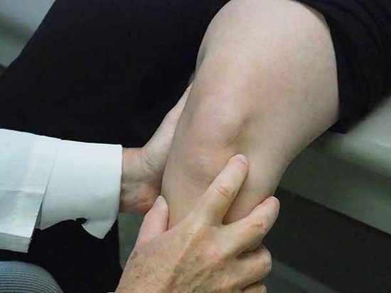 معاینه پزشک برای تشخیص پارگی مینیسک زانو