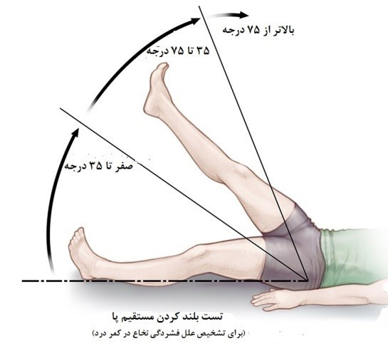 نحوه تشخیص درد سیاتیک