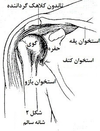 تعویض مفصل شانه