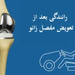 رانندگی بعد از تعویض مفصل زانو