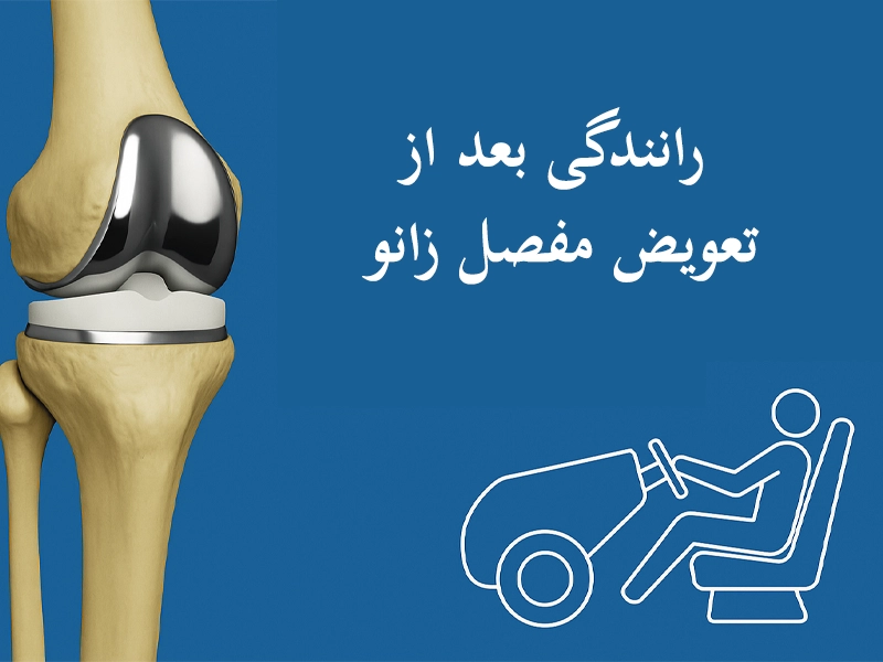 رانندگی بعد از تعویض مفصل زانو